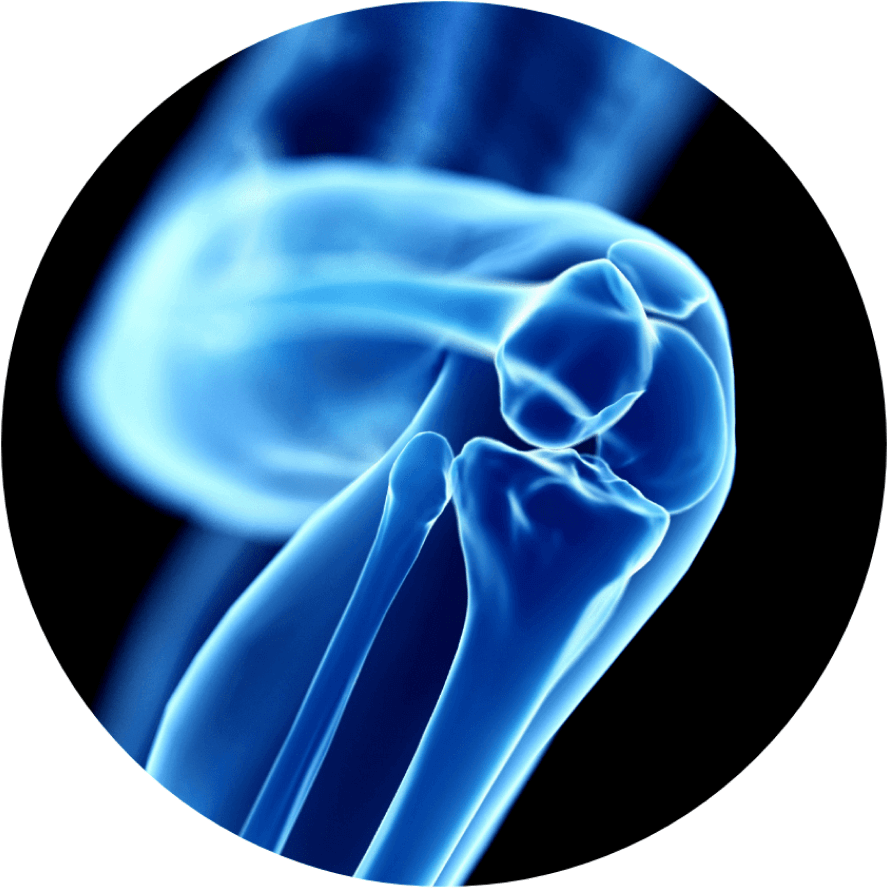 Patient with improved mobility after treatment